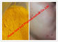 Порошки желтого цвета сырцовые стероидные/Исотретиноин для раков кожи, КАС 4759-48-2 поставщик